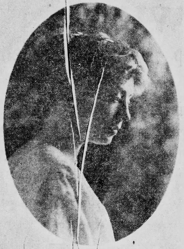 A young woman in profile in an oval frame, 1914, the damaged original